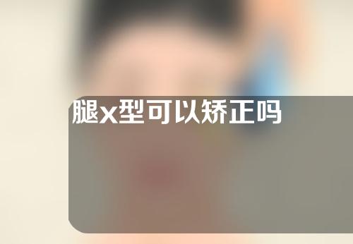 腿x型可以矫正吗