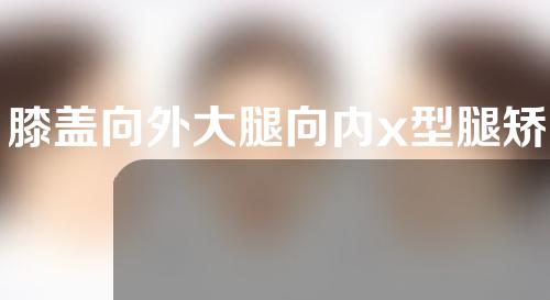 膝盖向外大腿向内x型腿矫正
