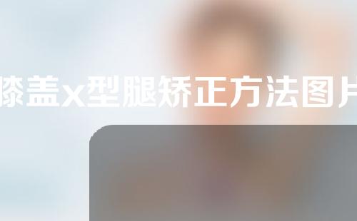 膝盖x型腿矫正方法图片