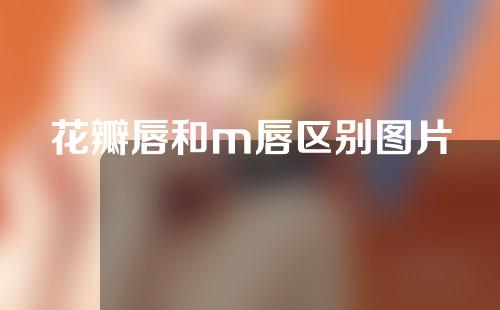 花瓣唇和m唇区别图片