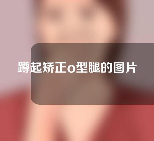 蹲起矫正o型腿的图片