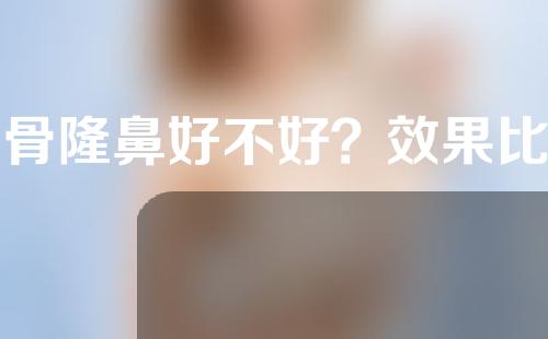 软骨隆鼻好不好？效果比硅胶隆鼻好吗？收藏了解