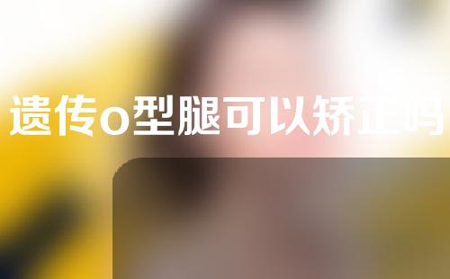 遗传o型腿可以矫正吗