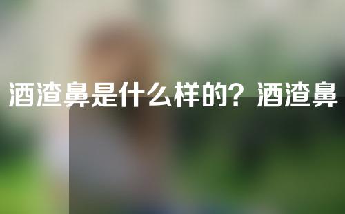 酒渣鼻是什么样的？酒渣鼻治疗有哪些注意事项？