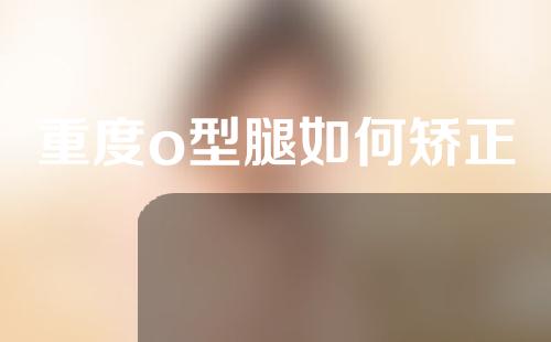 重度o型腿如何矫正