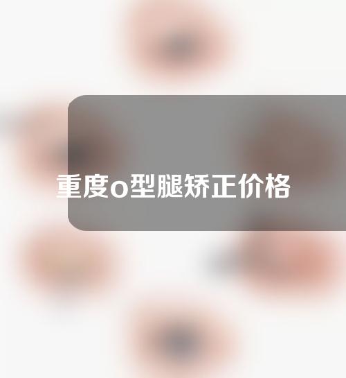 重度o型腿矫正价格