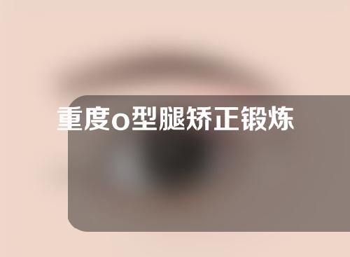 重度o型腿矫正锻炼