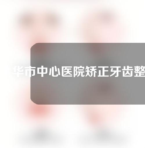 金华市中心医院矫正牙齿整形怎么样？牙齿整形揭秘！