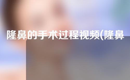 隆鼻的手术过程视频(隆鼻手术过程视频男)