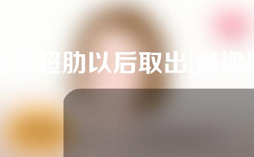 隆鼻超肋以后取出,鼻梁膨体用不用一起取出(肋骨鼻膨体取出保留肋骨)