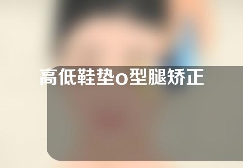 高低鞋垫o型腿矫正