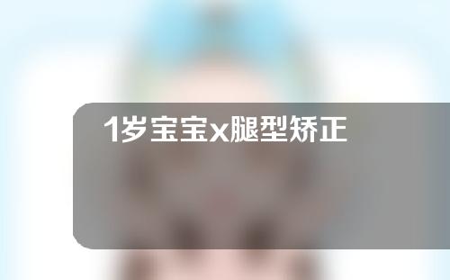 1岁宝宝x腿型矫正