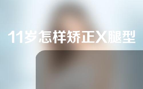 11岁怎样矫正X腿型