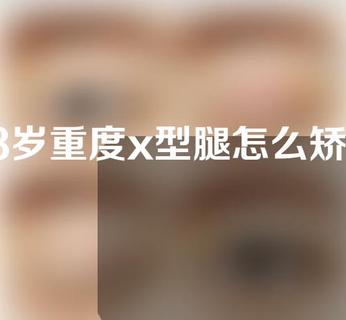 13岁重度x型腿怎么矫正