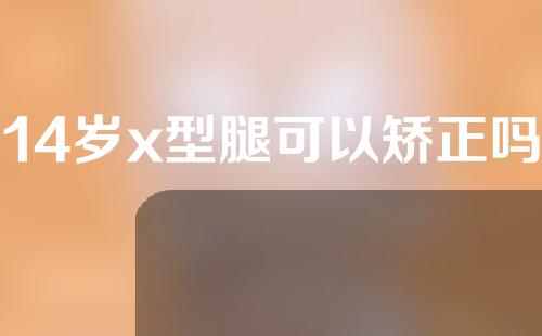 14岁x型腿可以矫正吗
