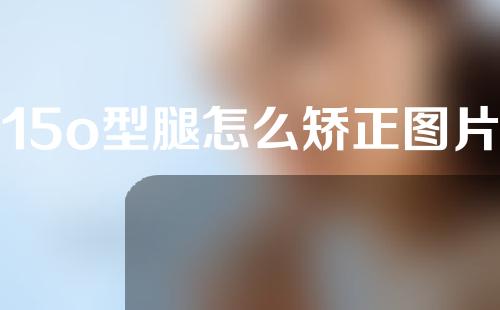 15o型腿怎么矫正图片