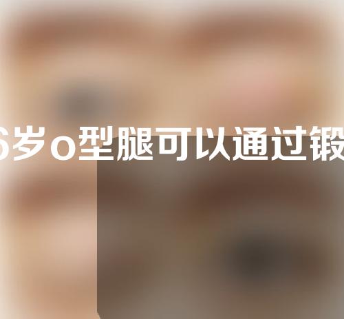 16岁o型腿可以通过锻炼矫正吗