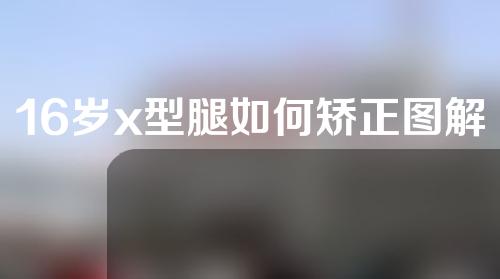 16岁x型腿如何矫正图解