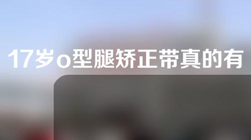 17岁o型腿矫正带真的有效果吗