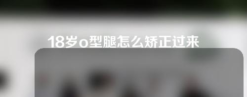 18岁o型腿怎么矫正过来