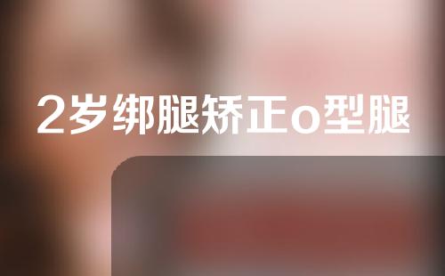 2岁绑腿矫正o型腿