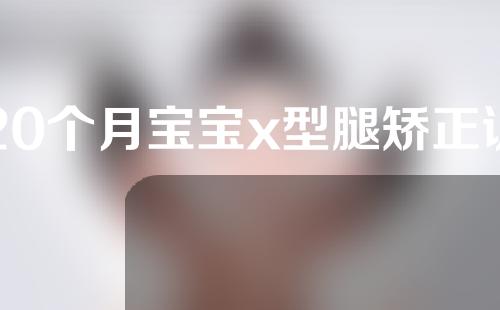 20个月宝宝x型腿矫正训练方法