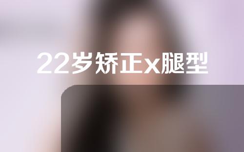 22岁矫正x腿型