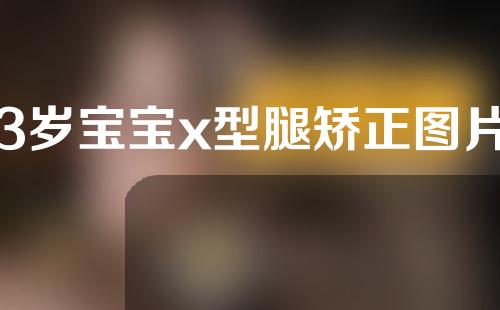 3岁宝宝x型腿矫正图片