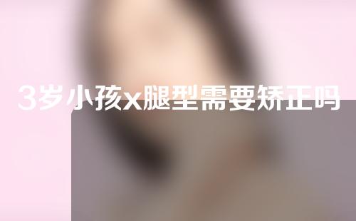 3岁小孩x腿型需要矫正吗