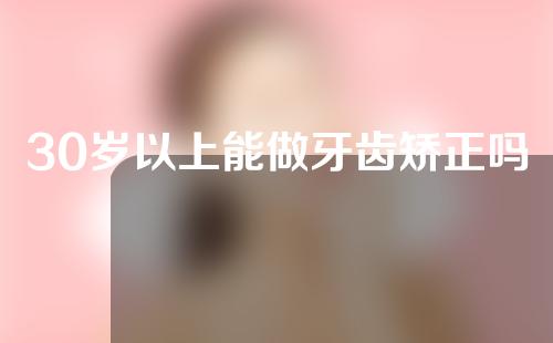 30岁以上能做牙齿矫正吗(30岁以上能做牙齿矫正吗女)