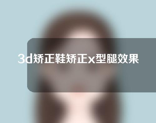 3d矫正鞋矫正x型腿效果怎样