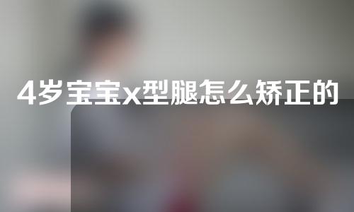 4岁宝宝x型腿怎么矫正的窍门