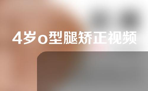 4岁o型腿矫正视频