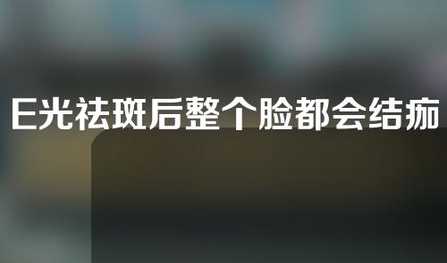 E光祛斑后整个脸都会结痂吗