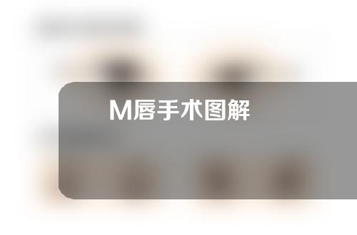 M唇手术图解