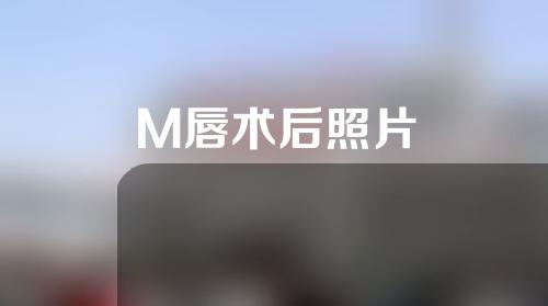 M唇术后照片