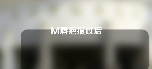 M唇疤痕过后