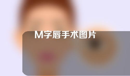 M字唇手术图片