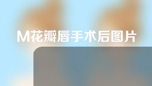 M花瓣唇手术后图片