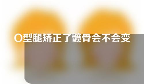 O型腿矫正了髋骨会不会变小