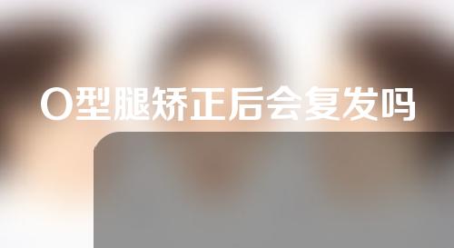 O型腿矫正后会复发吗