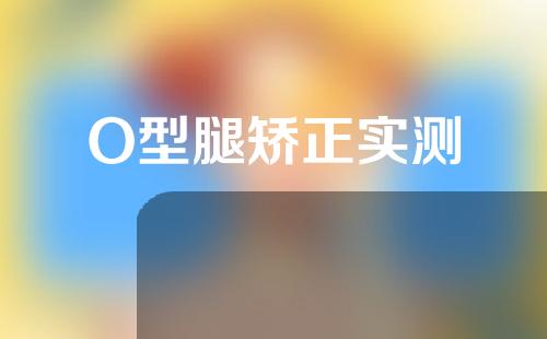 O型腿矫正实测