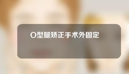 O型腿矫正手术外固定