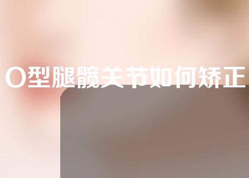 O型腿髋关节如何矫正