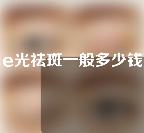 e光祛斑一般多少钱