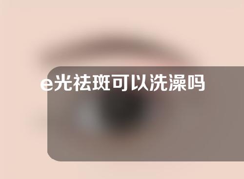 e光祛斑可以洗澡吗