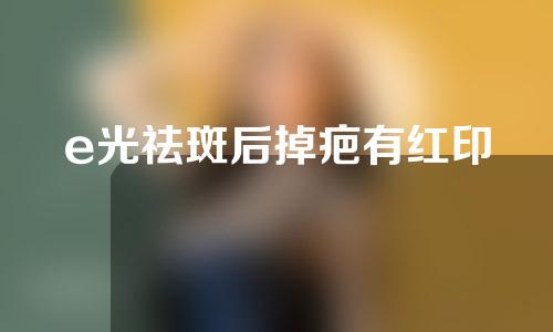 e光祛斑后掉疤有红印