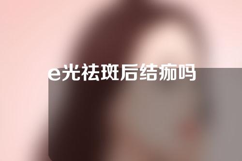 e光祛斑后结痂吗