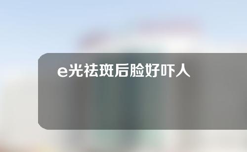 e光祛斑后脸好吓人