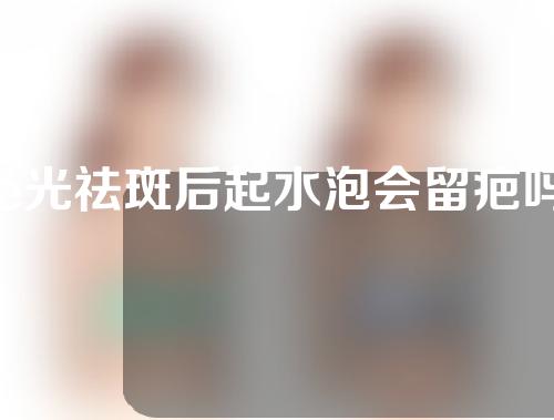 e光祛斑后起水泡会留疤吗
